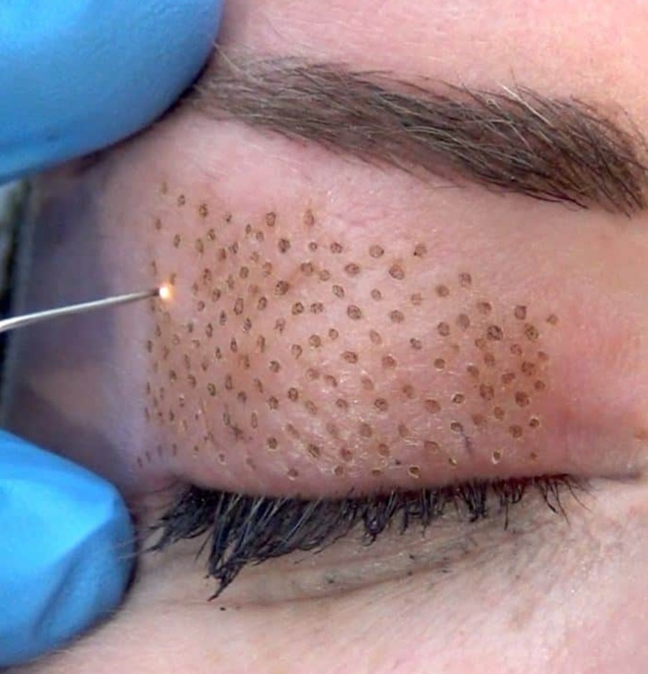 Étudiante réalisant un soin esthétique en formation